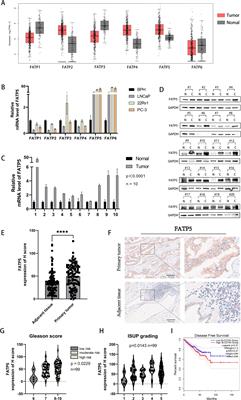 FATP5 modulates biological activity and lipid metabolism in prostate cancer through the TEAD4-mediated Hippo signaling